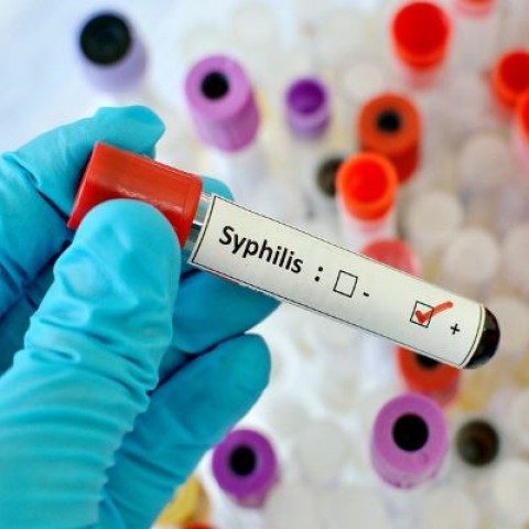 Syphilis- Dermatological Celebrity