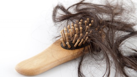 Some Facts About Hair Loss